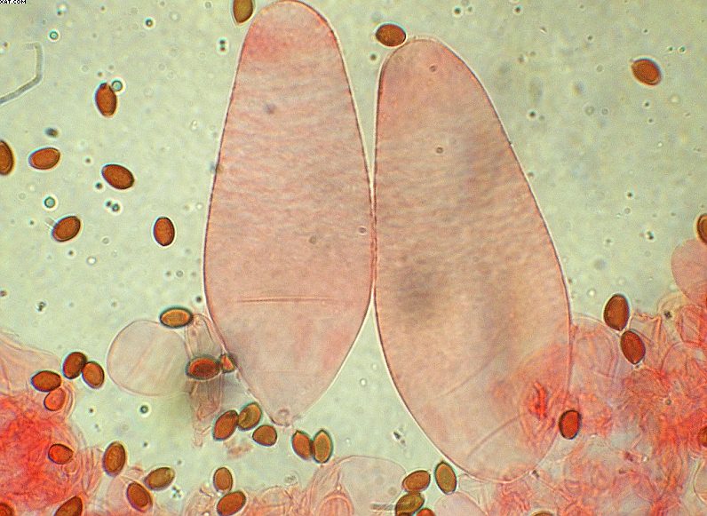 Coprinopsis strossmayeri (Schulzer) Redhead et al.